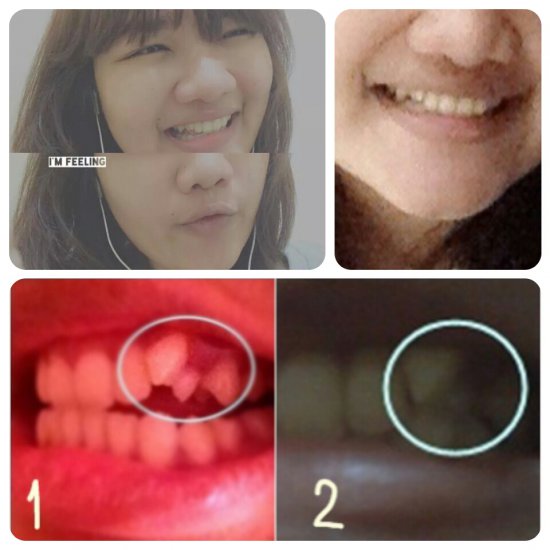 My Image 50