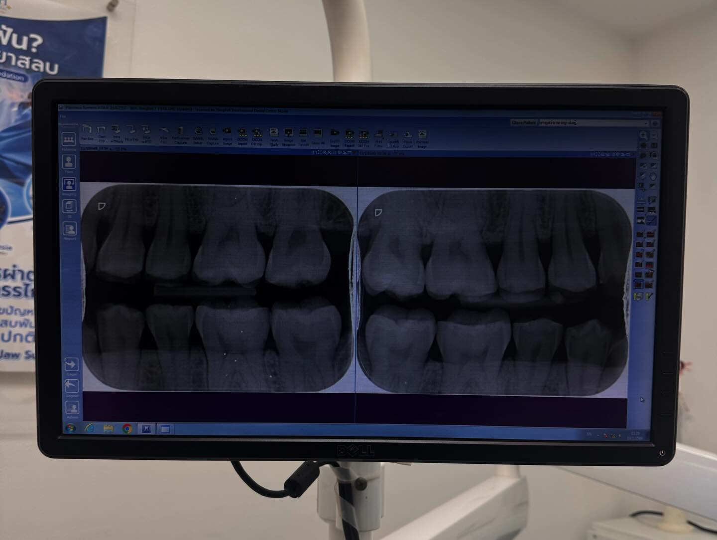 แพต - ชญานิษฐ์ ชาญสง่าเวช