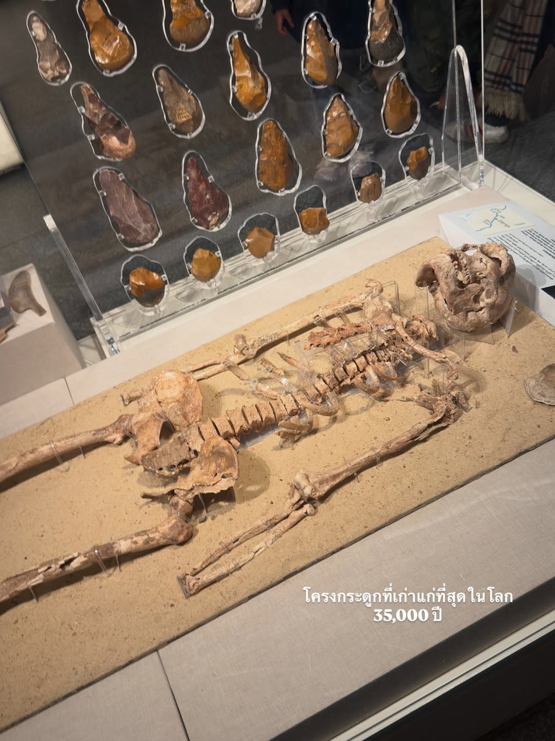 อาย - กมลเนตร เรืองศรี