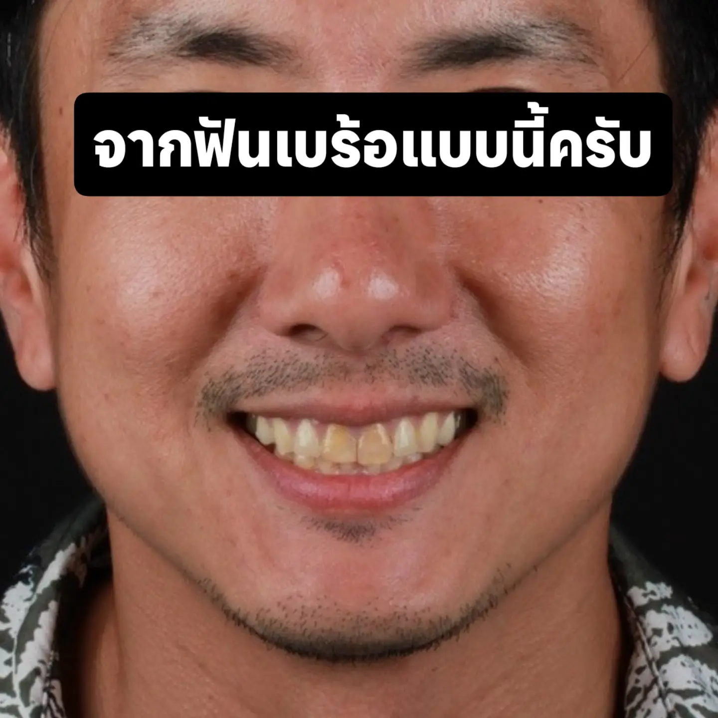 สิงห์ - วรรณสิงห์ ประเสริฐกุล