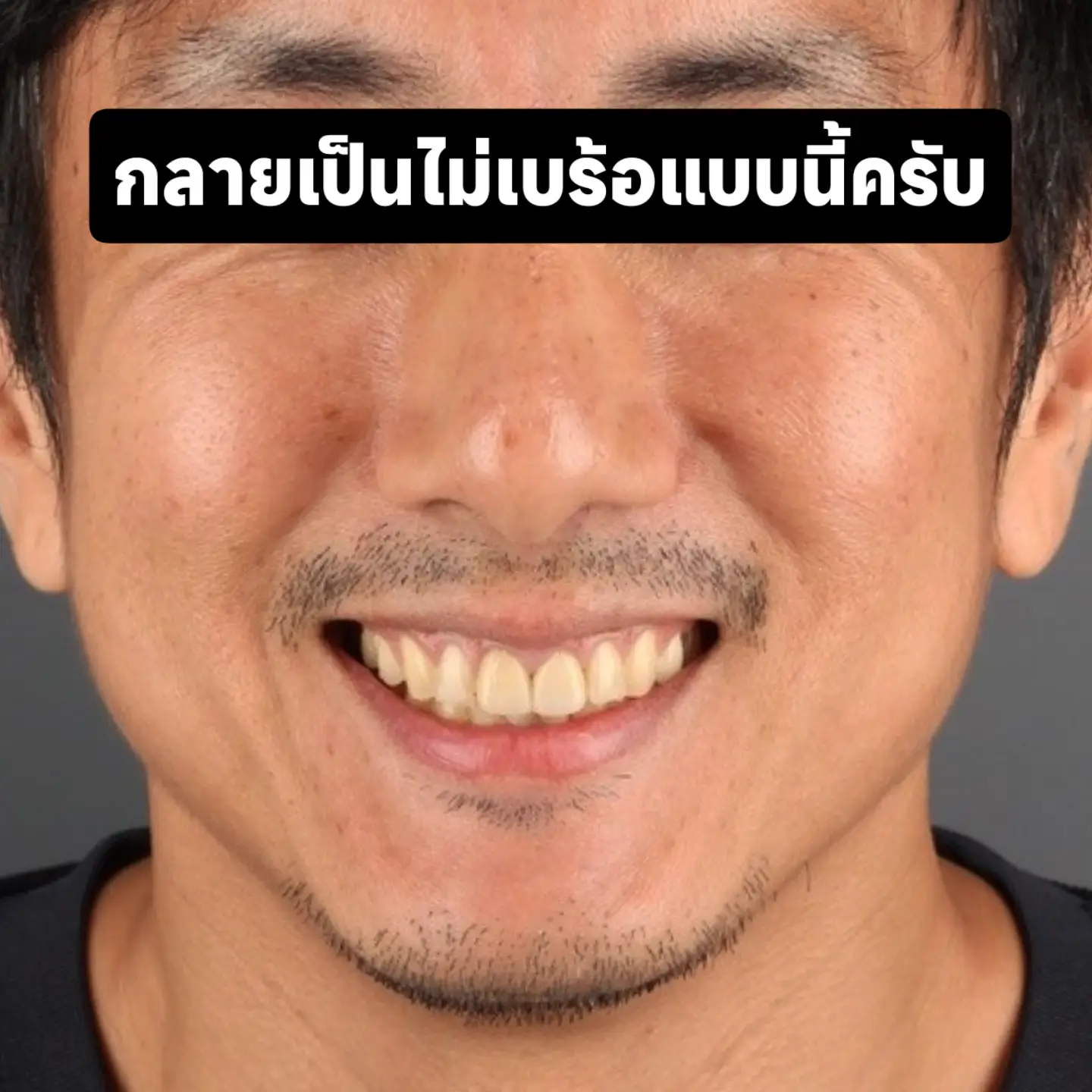 สิงห์ - วรรณสิงห์ ประเสริฐกุล