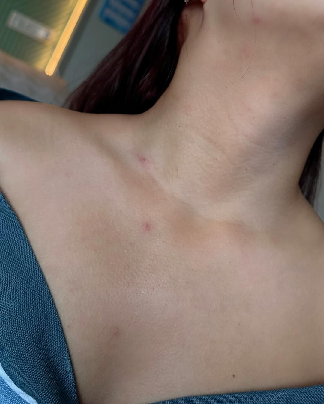 ลิลลี่ - นารีนาท เชื้อแหลม