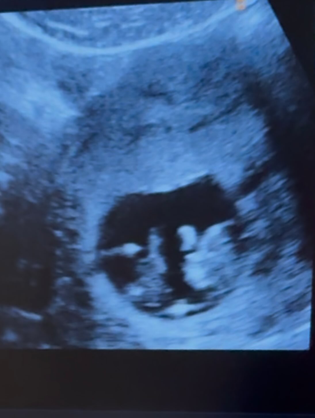 ปุยฝ้าย - ณัฏฐพัชร วิพัธครตระกูล