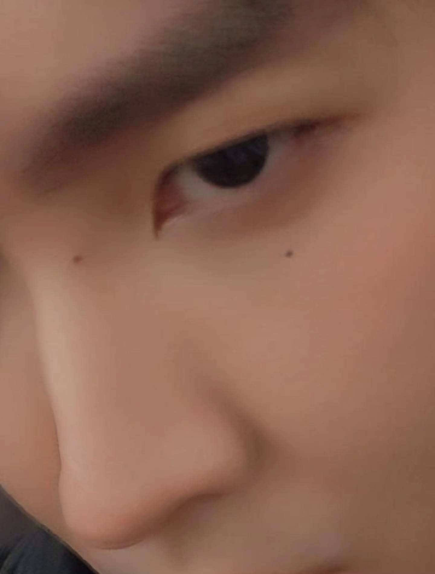 คิมม่อน - วโรดม เข็มมณฑา