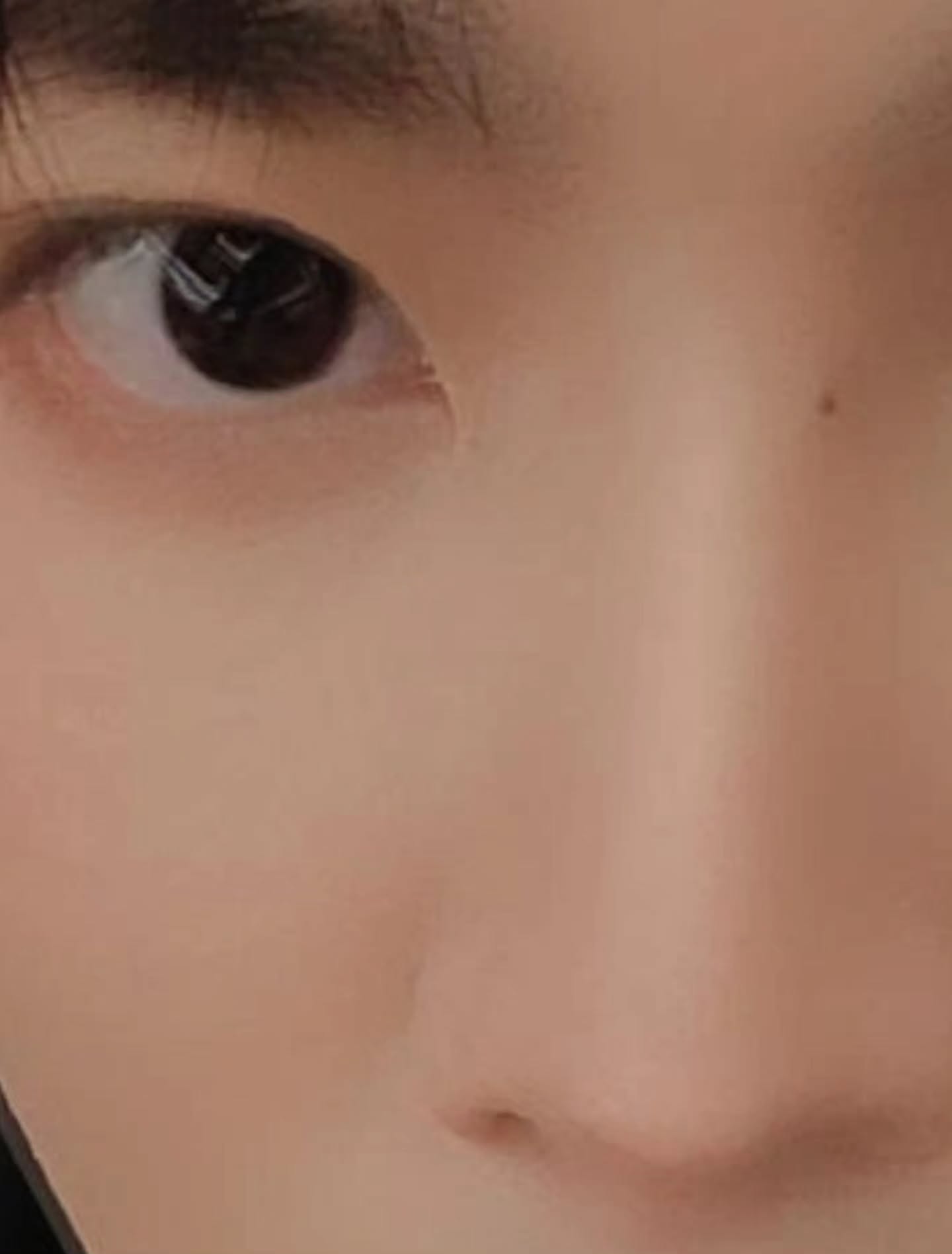 คิมม่อน - วโรดม เข็มมณฑา