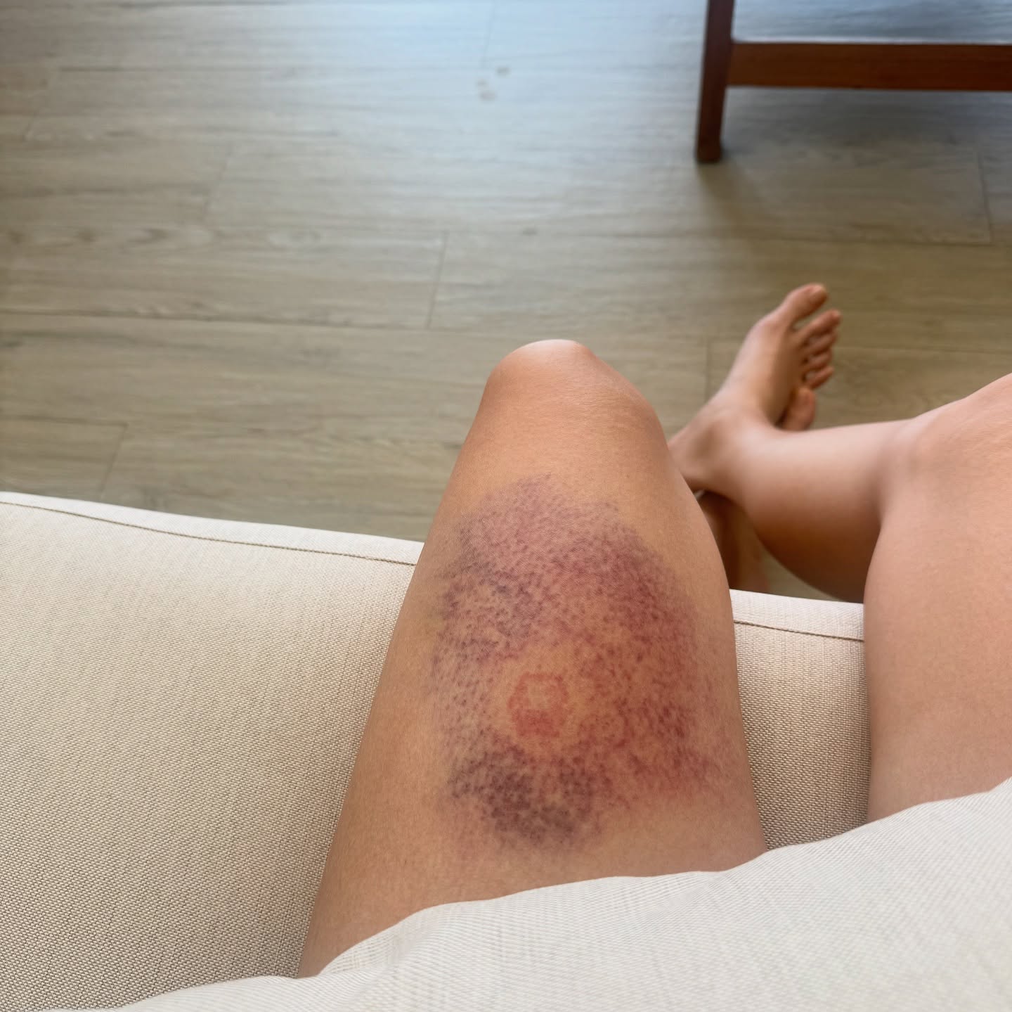 มะปราง - อลิสา ขุนแขวง