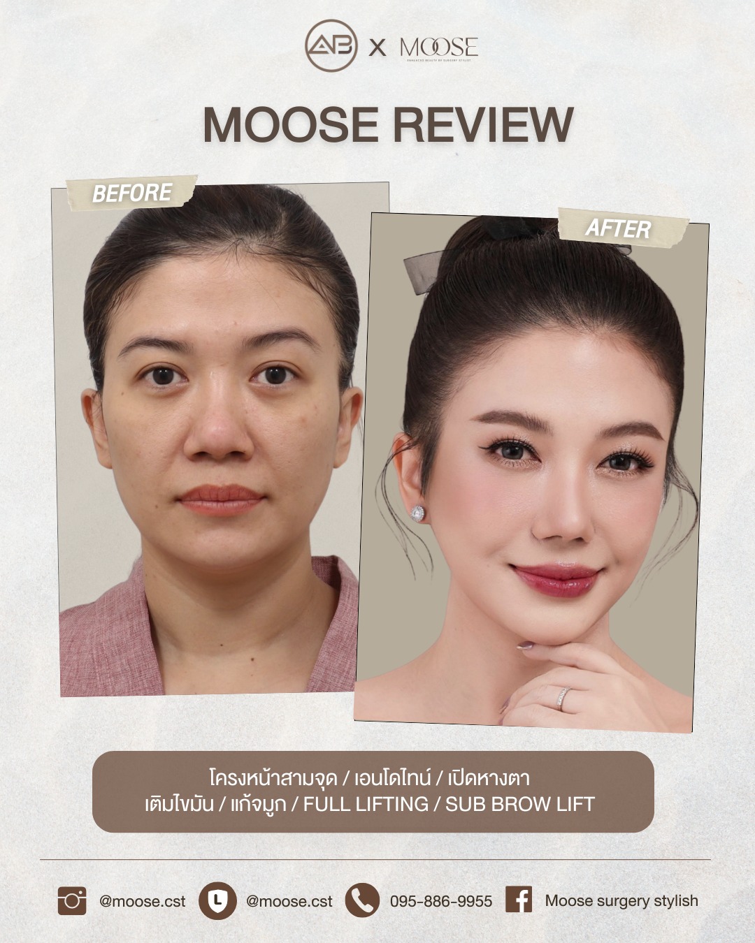 กวาง - วรรณปิยะ ออมสินนพกุล