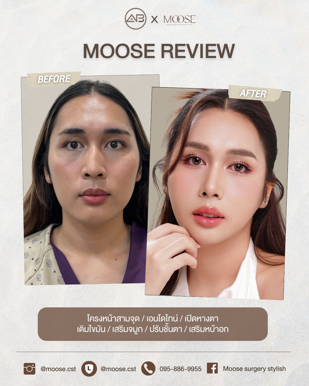 กวาง - วรรณปิยะ ออมสินนพกุล