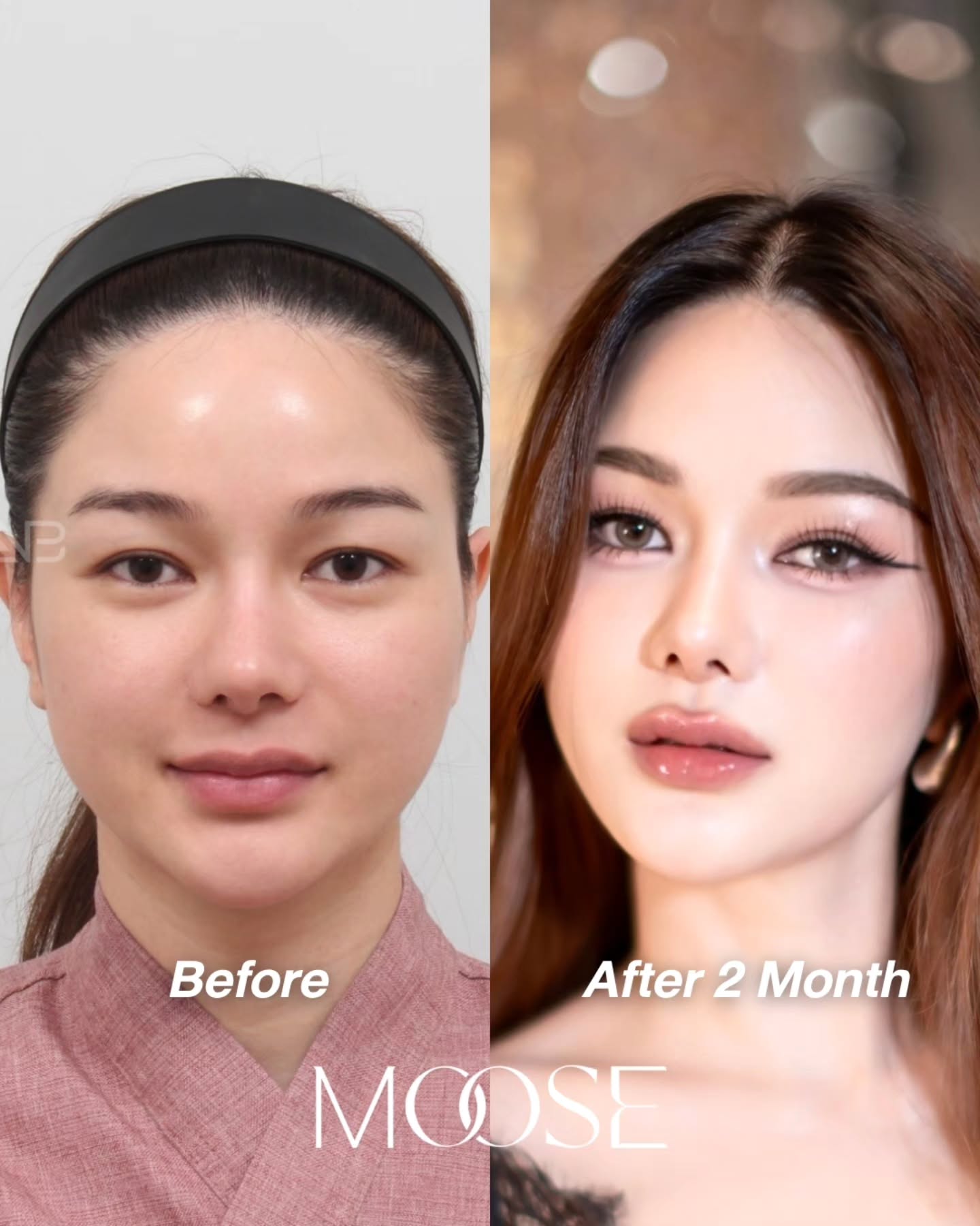 กวาง - วรรณปิยะ ออมสินนพกุล