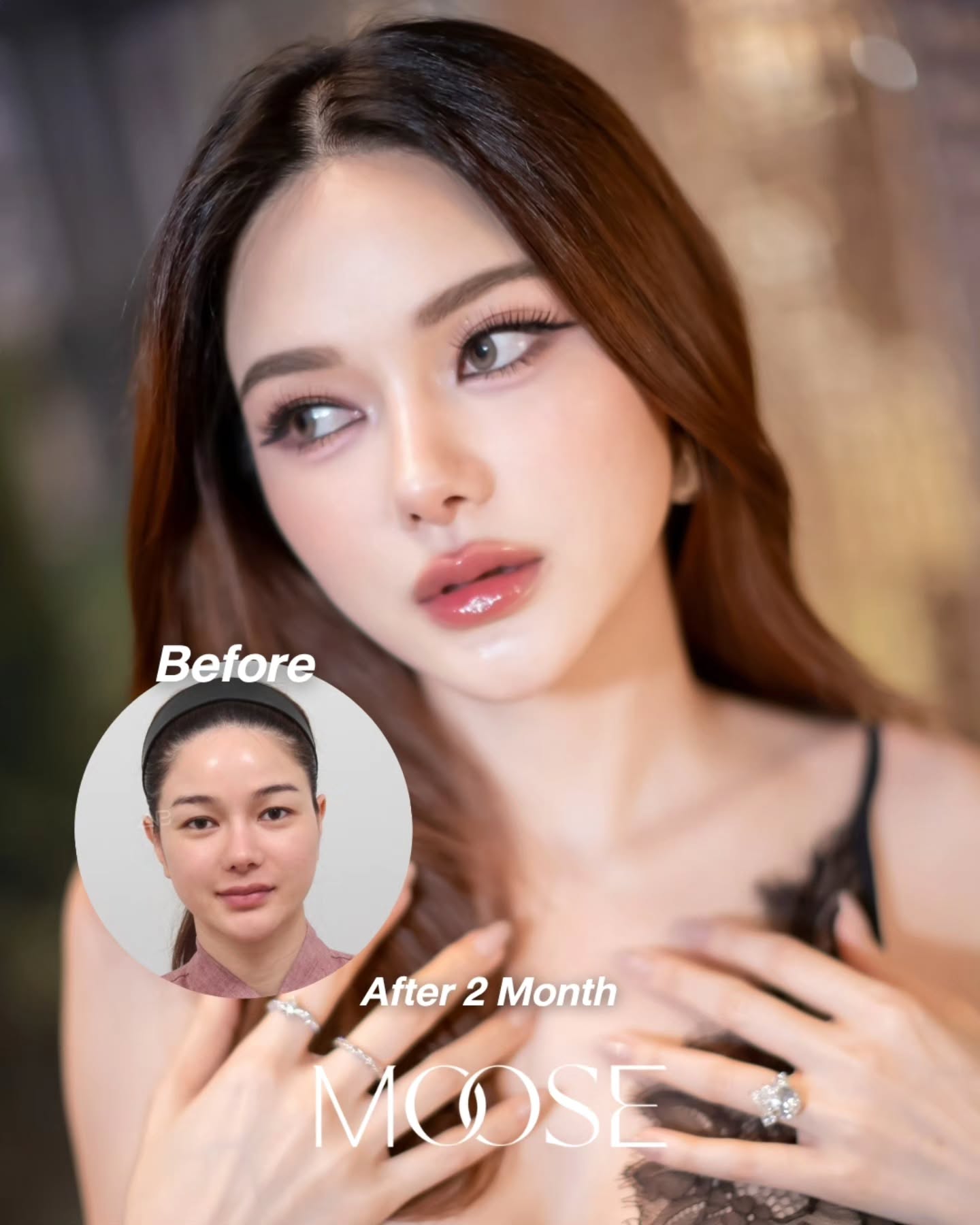 กวาง - วรรณปิยะ ออมสินนพกุล