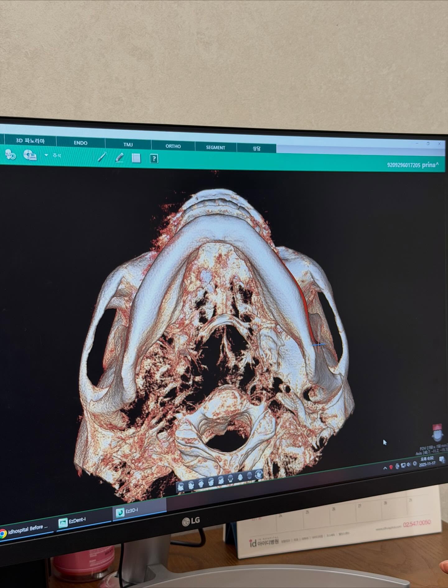 กวาง - วรรณปิยะ ออมสินนพกุล