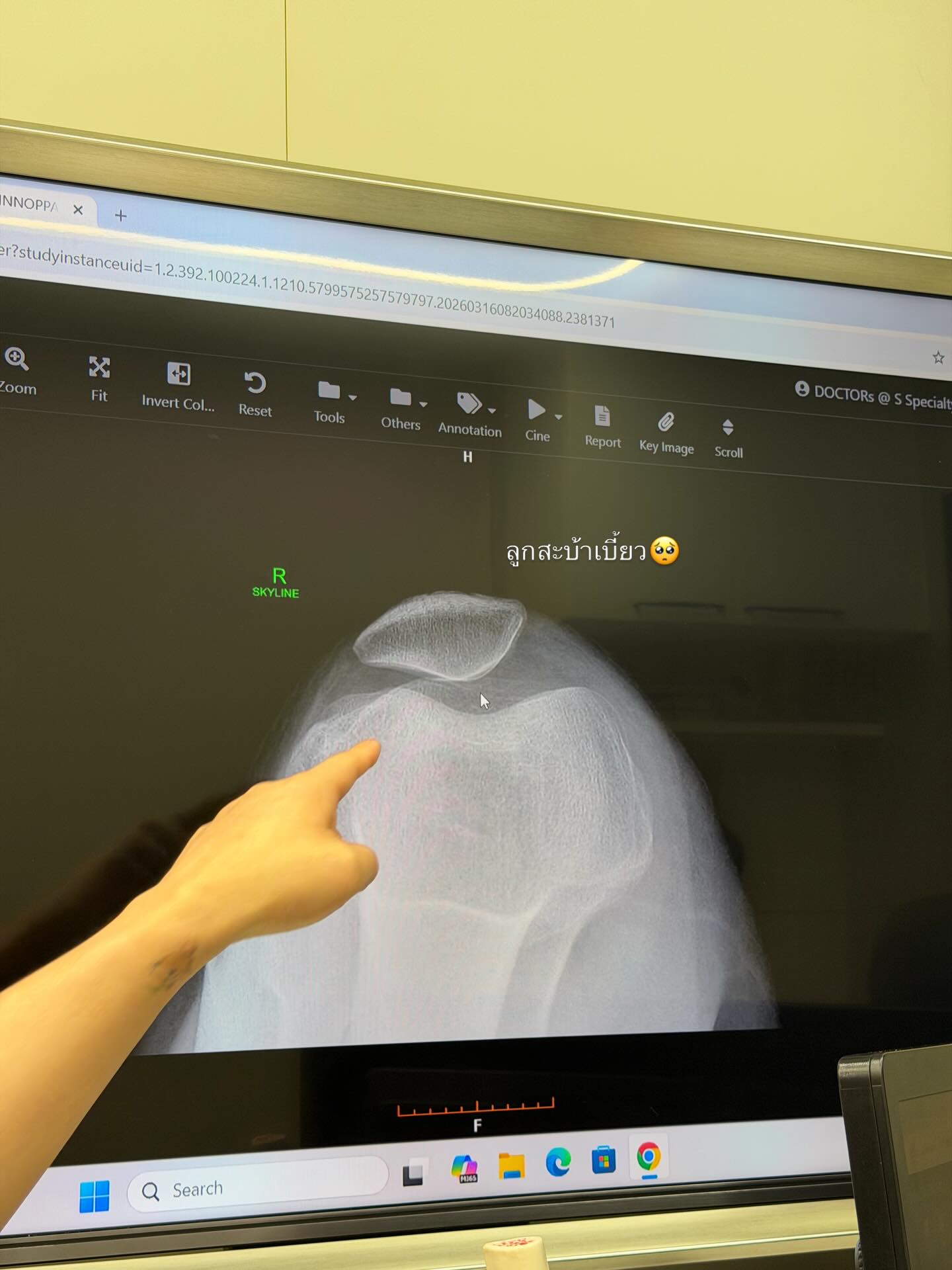 กวาง - วรรณปิยะ ออมสินนพกุล