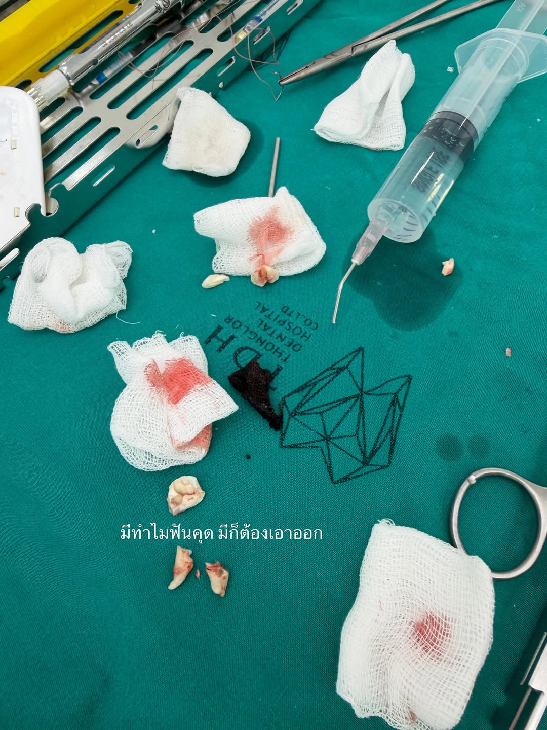 คารีสา สปริงเก็ตต์
