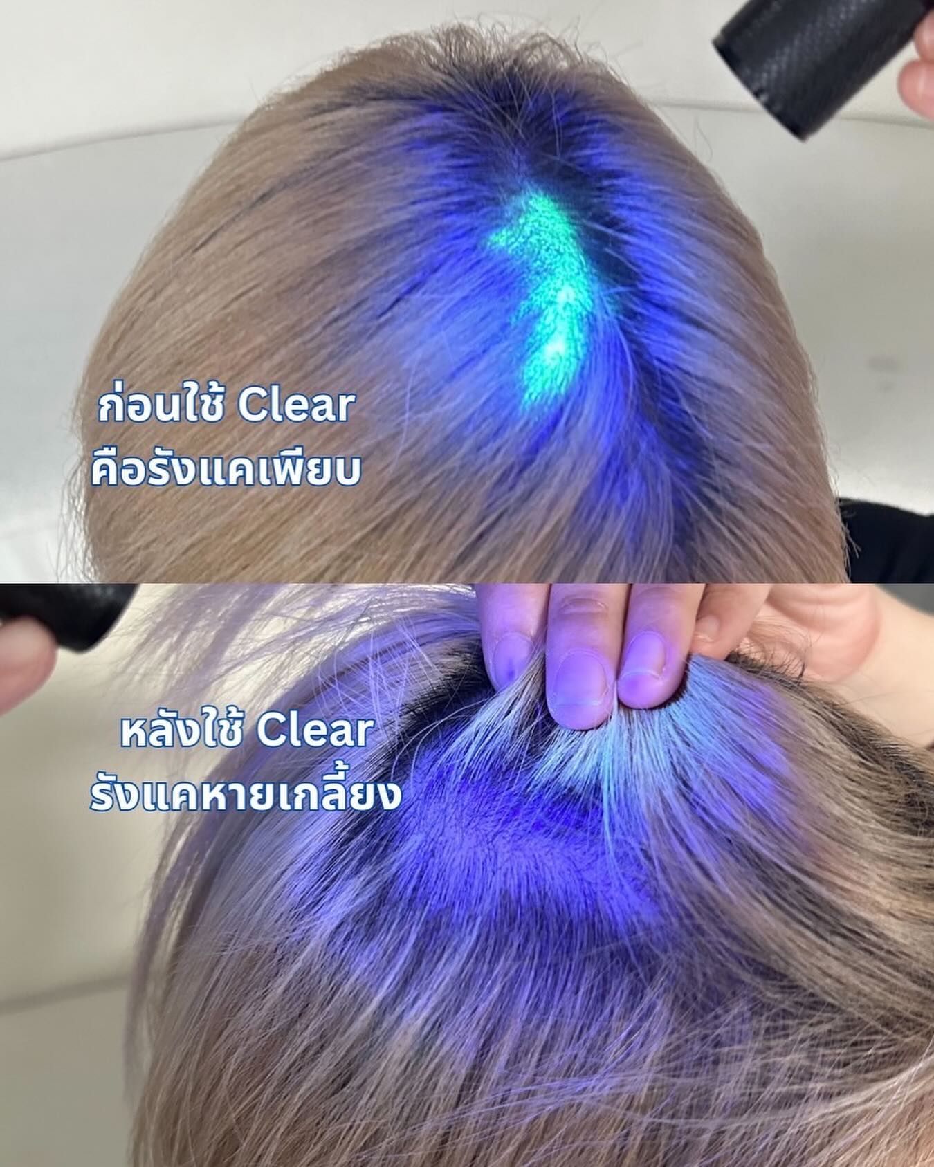 นิวเคลียร์ - หรรษา จึงวิวัฒนวงศ์