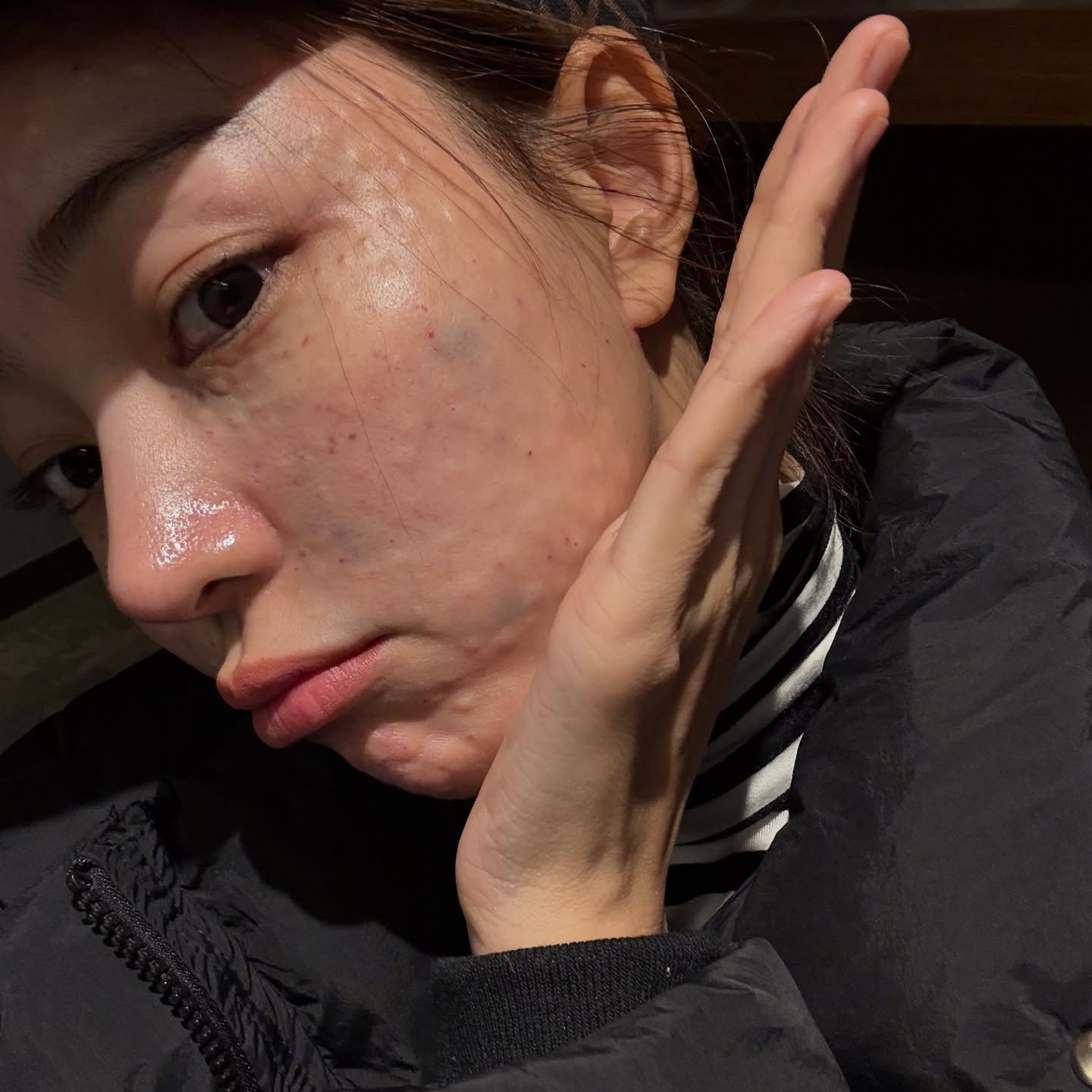 นิวเคลียร์ - หรรษา จึงวิวัฒนวงศ์