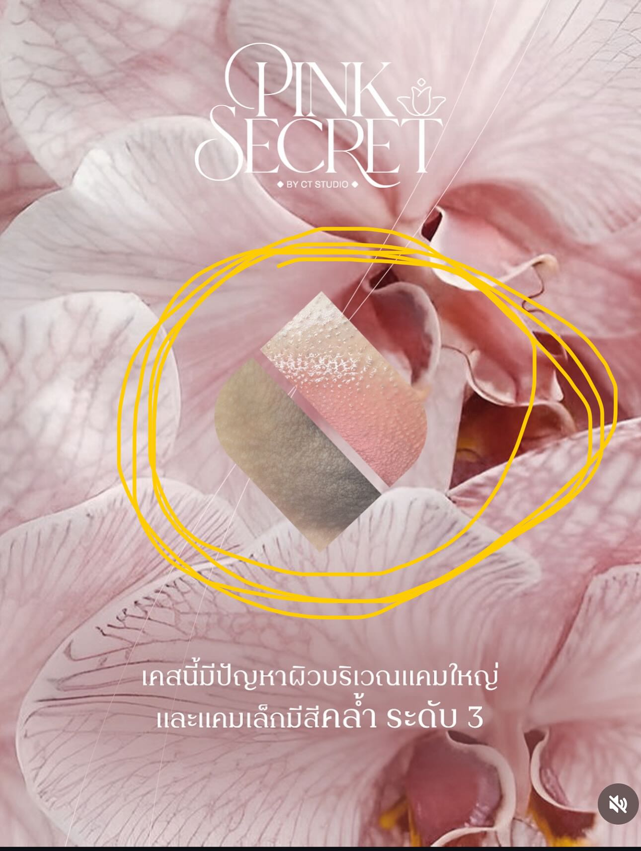 ต้นหอม - ศกุนตลา เทียนไพโรจน์