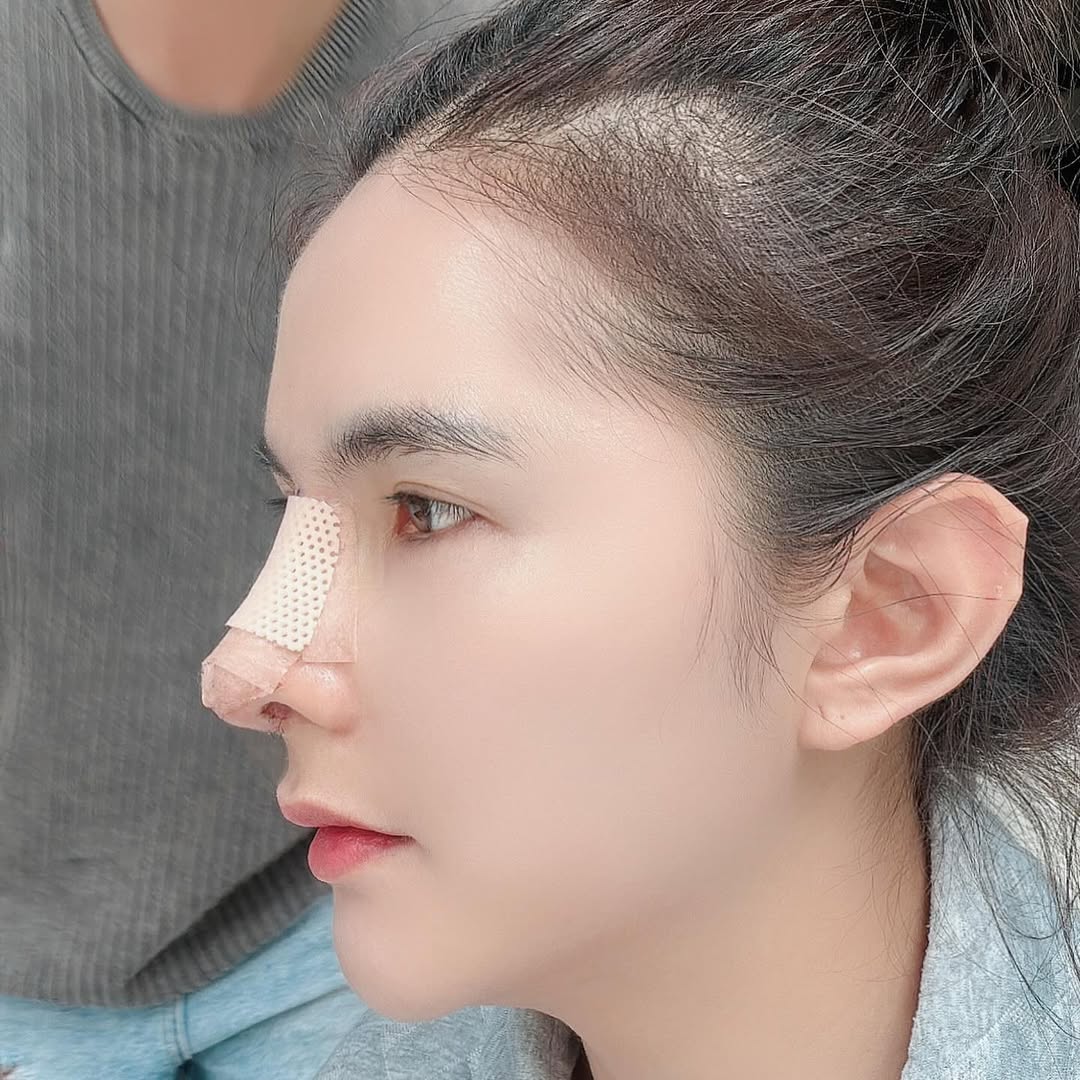 เบล - ขนิษฐา เบ้าหล่อเพชร