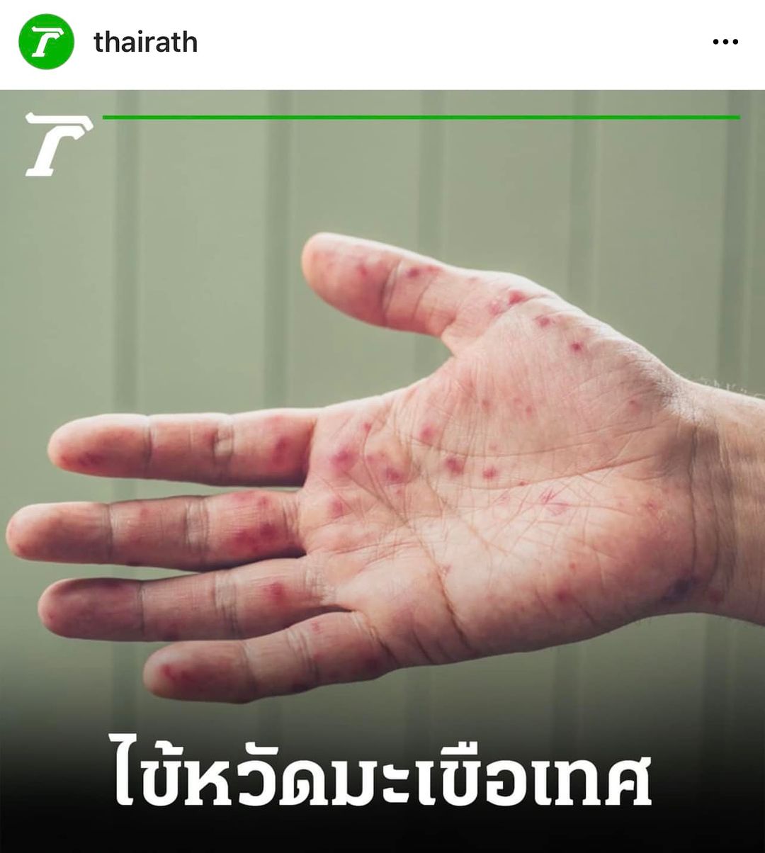 หนุ่ม - คงกะพัน แสงสุริยะ