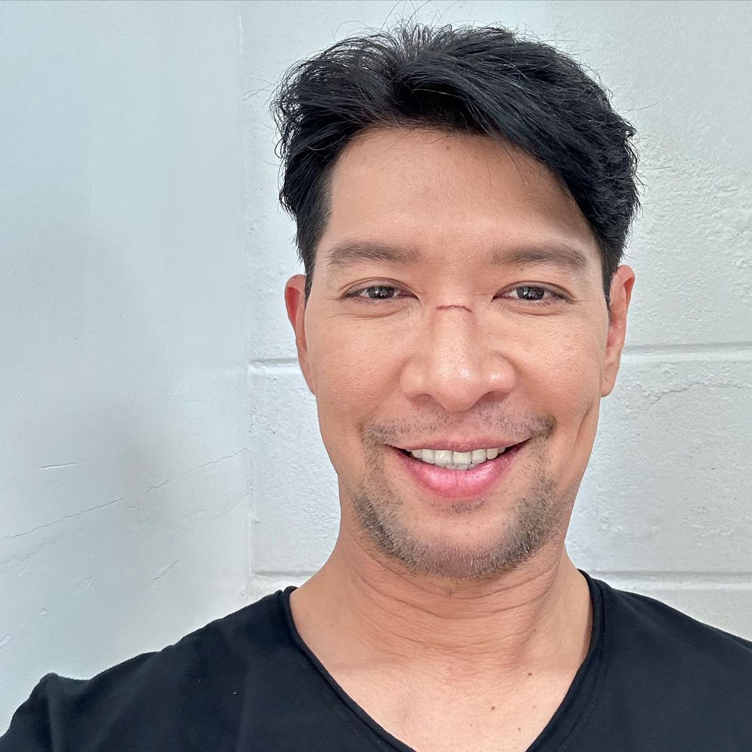 หนุ่ม - คงกะพัน แสงสุริยะ