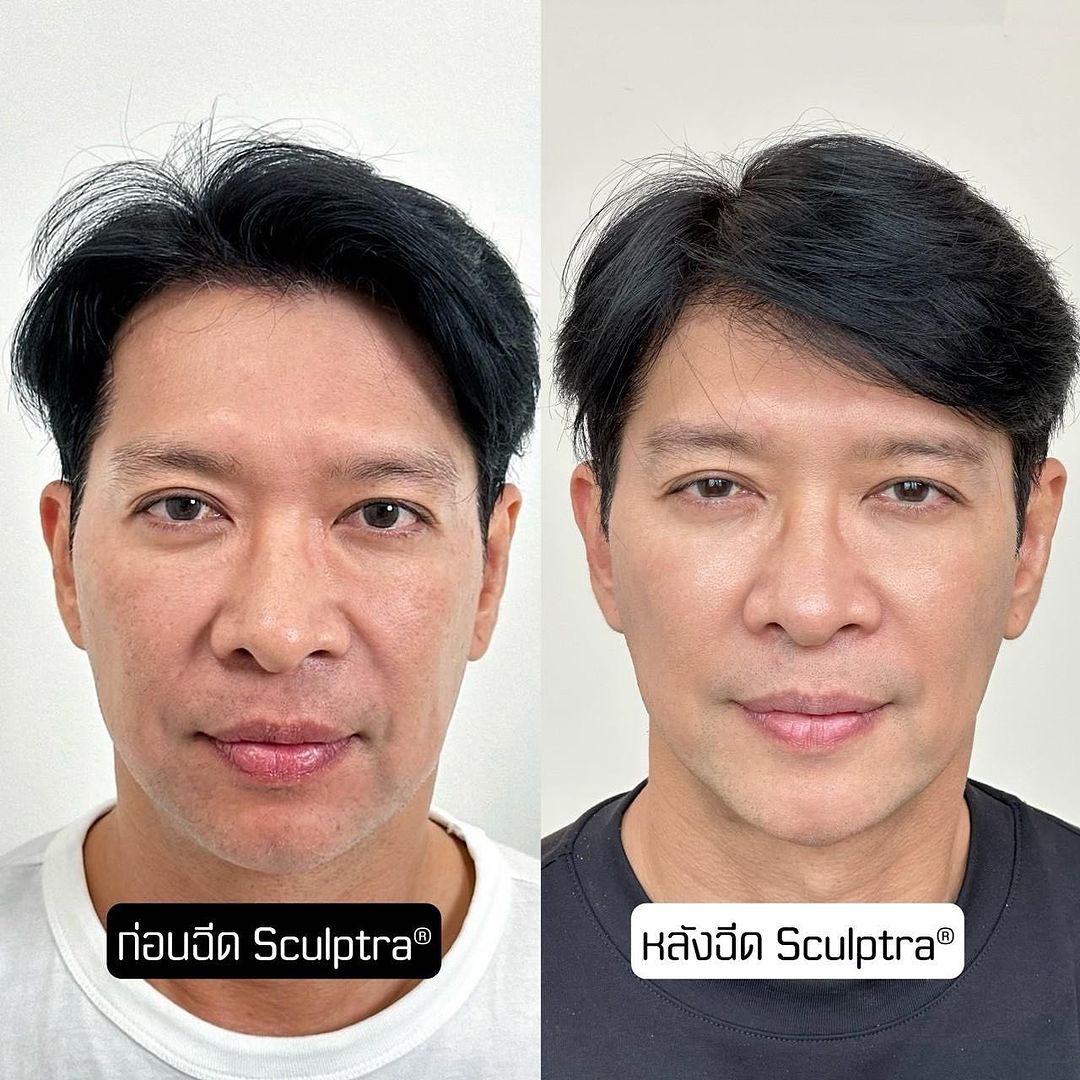 หนุ่ม - คงกะพัน แสงสุริยะ