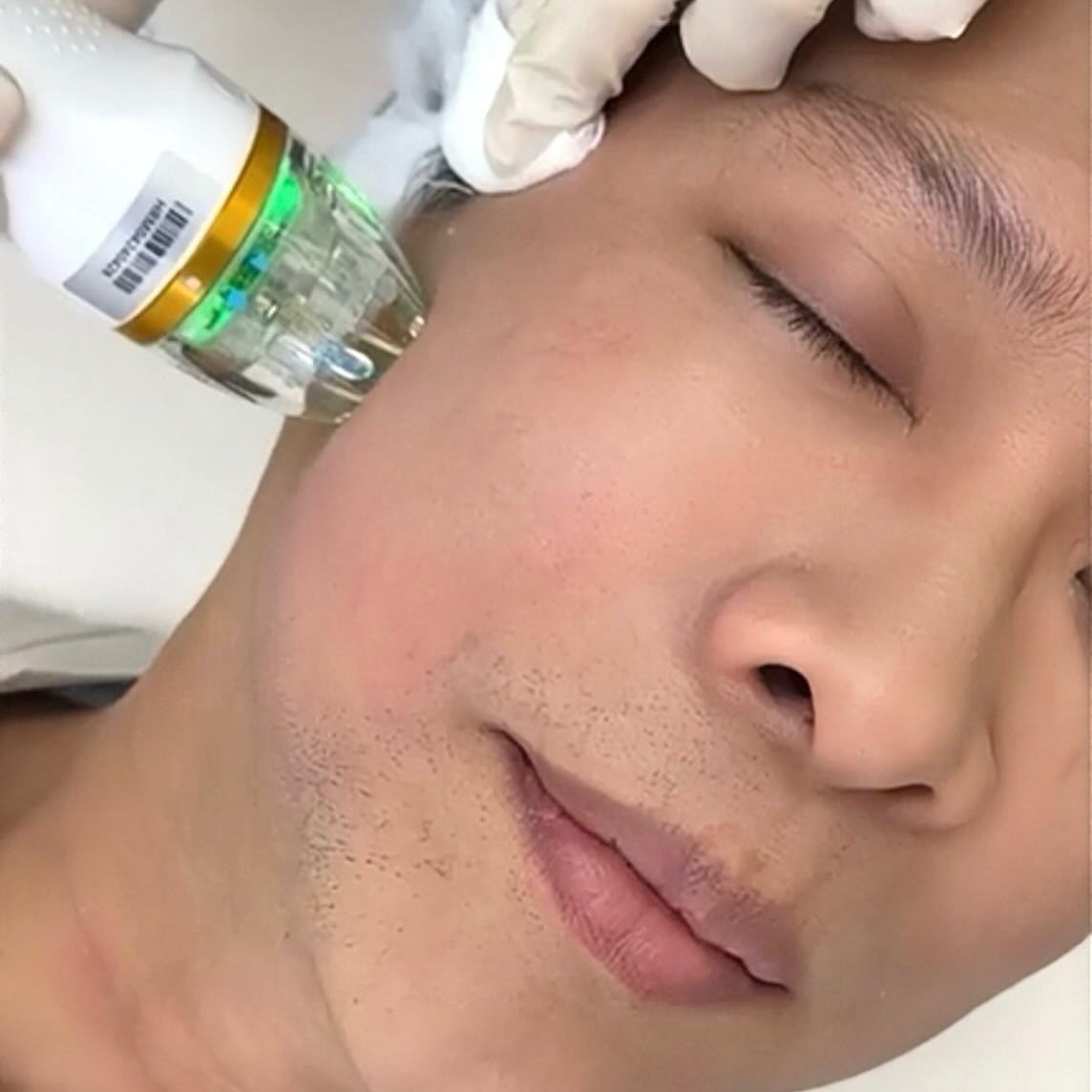 หนุ่ม - คงกะพัน แสงสุริยะ