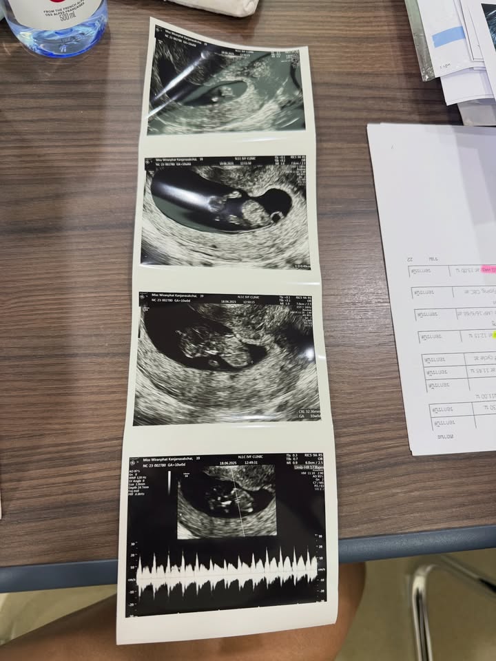 ปาย - สิตางศุ์ ปุณภพ