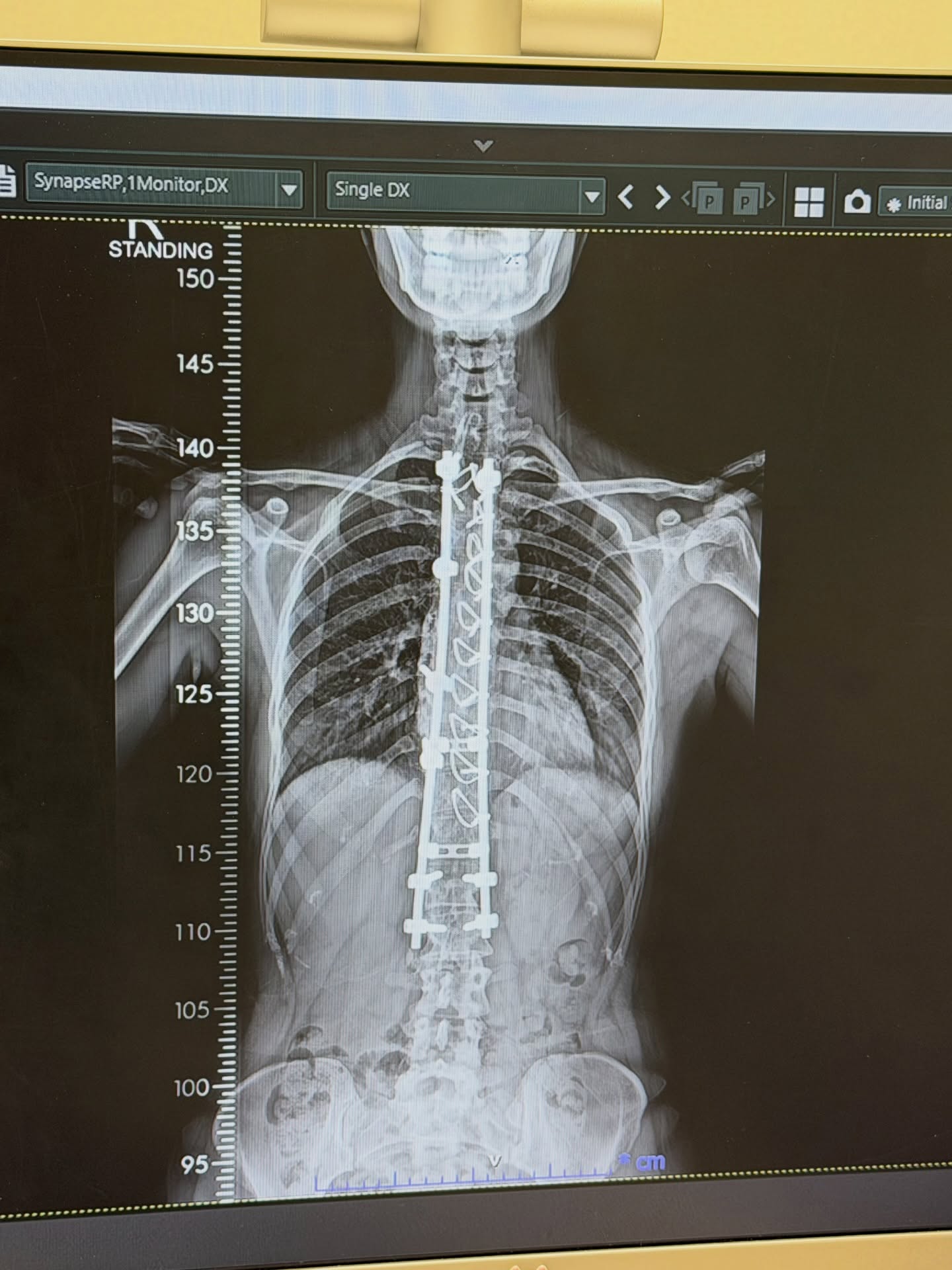 วี - วิโอเลต วอเทียร์