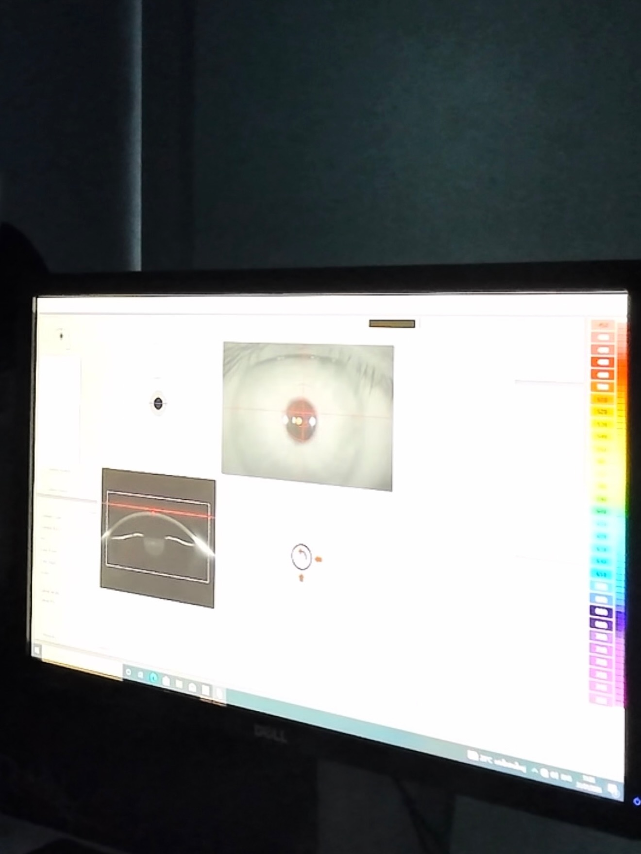 บิลลี่ - ภัทรชนน อ่อนสอาด