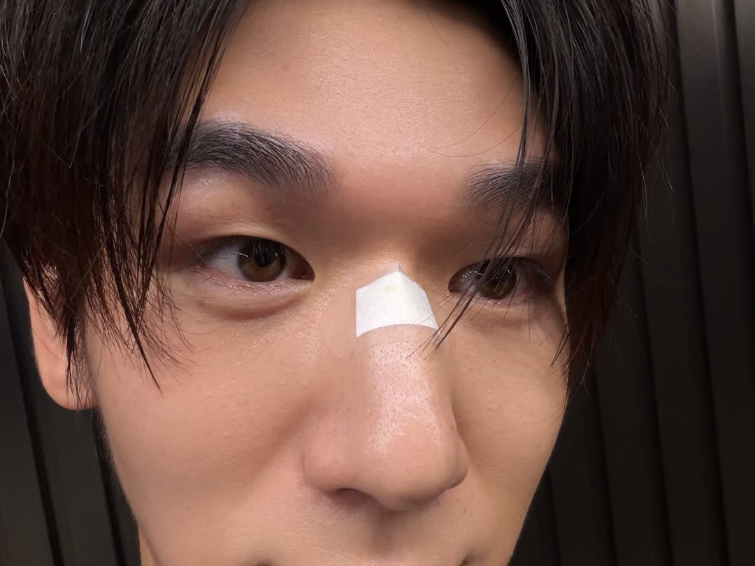 มอส - ภาณุวัฒน์ โสประดิษฐ