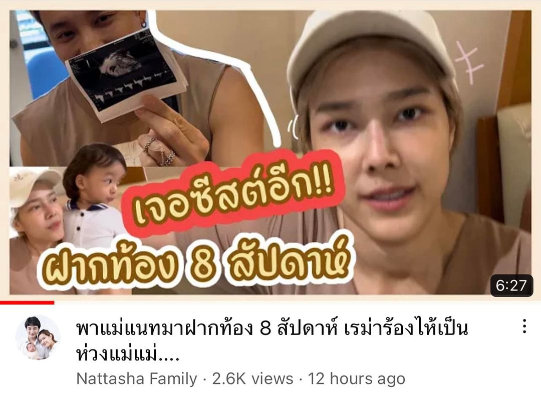 เป๊ก - รัฐภูมิ ไข่นาค