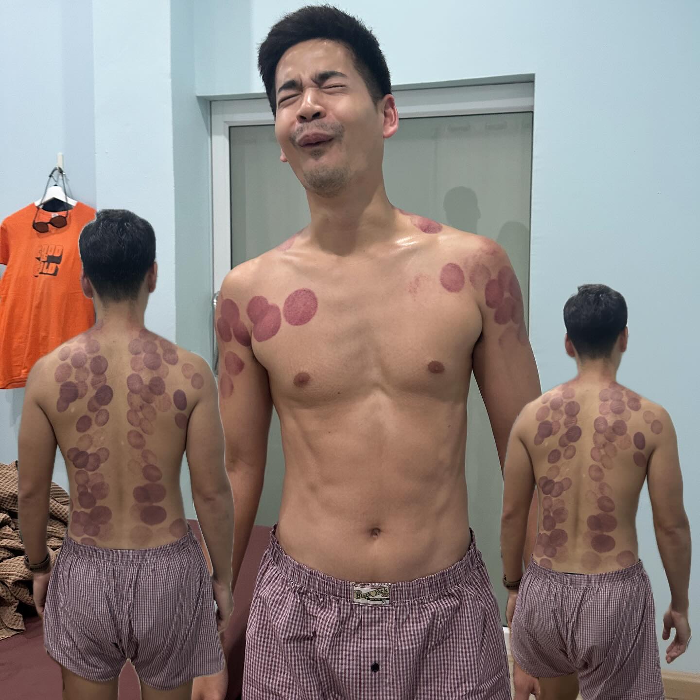 ฟรอยด์ - ณัฏฐพงษ์ ชาติพงศ์