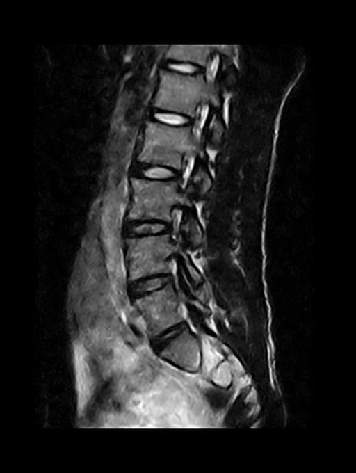 เจ็ท - ภัทร์ไพบูลย์ โอภาสสุวรรณ