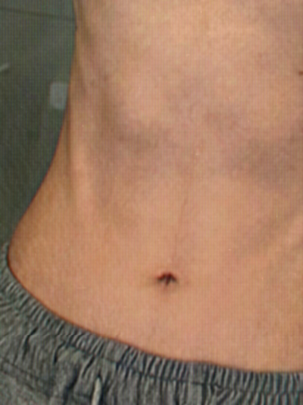 นัท - ศุภณัฐ เลาหะพานิช