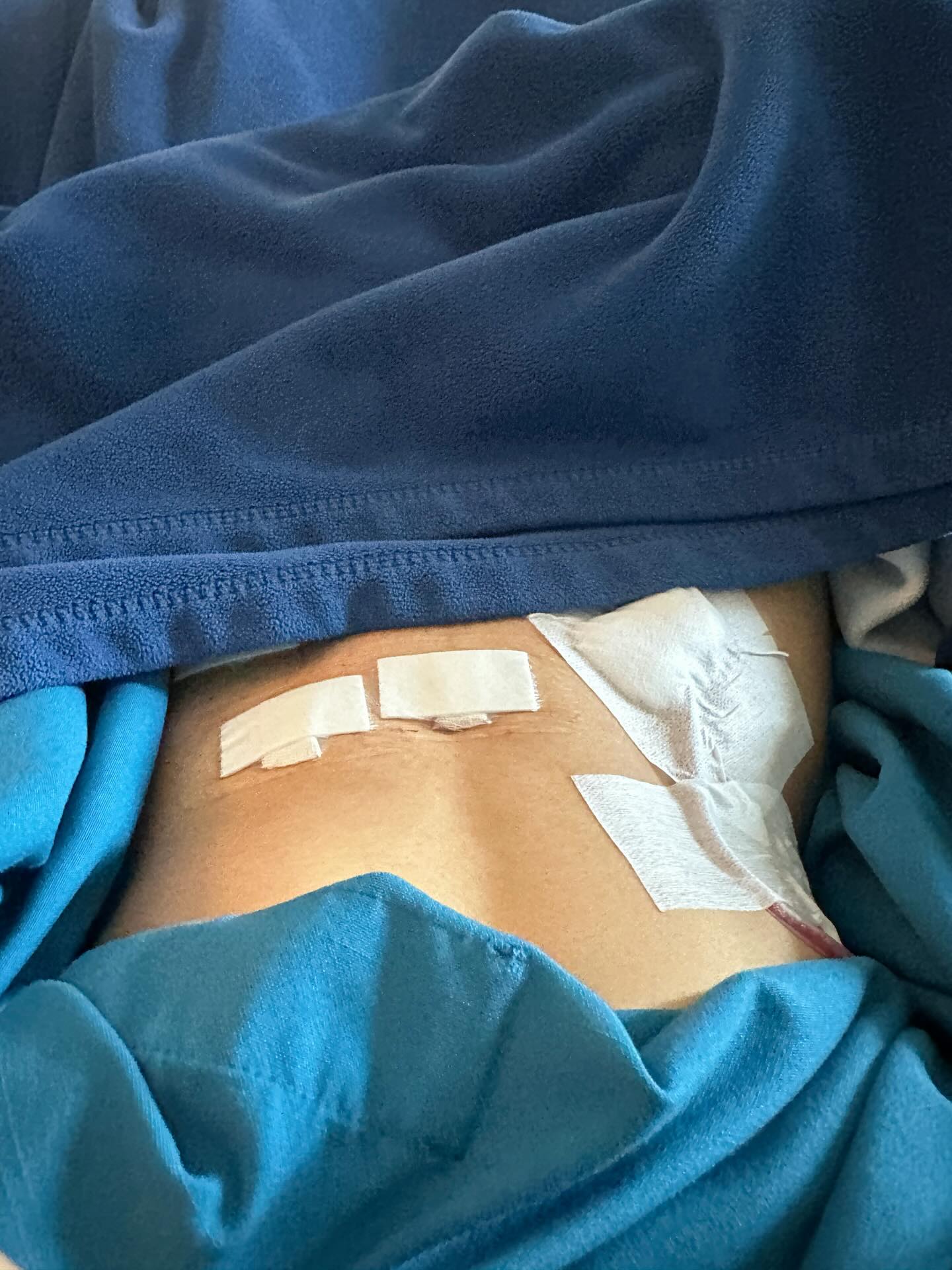 อุ้ม - ทวีพร พริ้งจำรัส