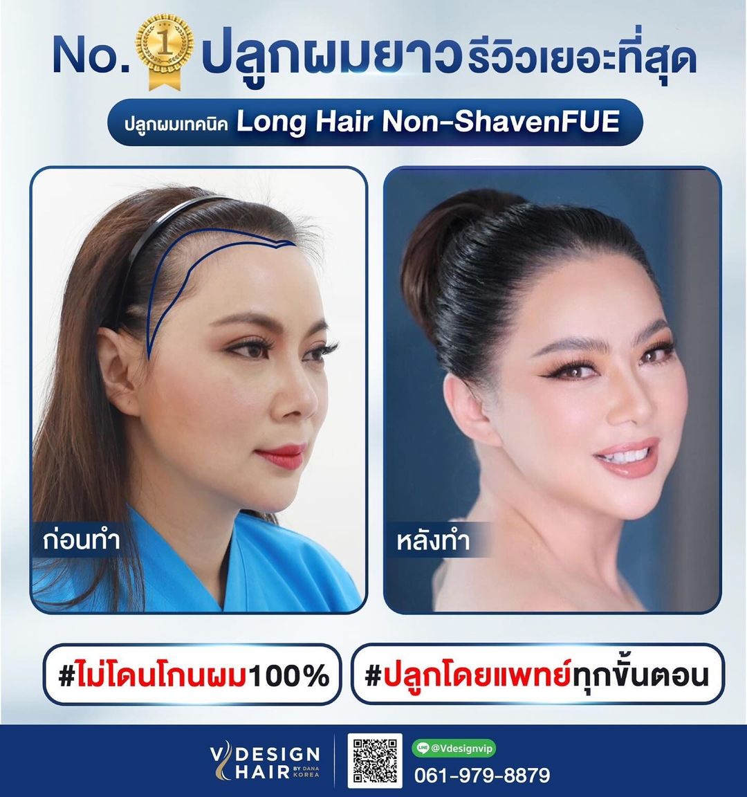 บุ๋ม - ปนัดดา วงศ์ผู้ดี