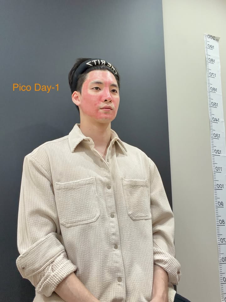 มีน - พีรวิชญ์ อรรถชิตสถาพร