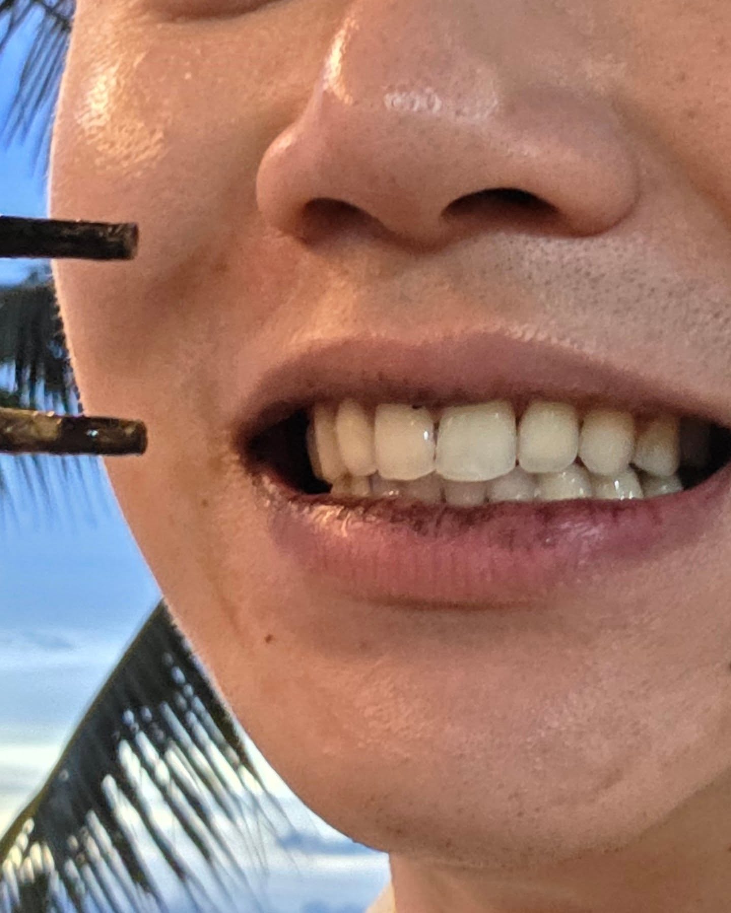 หยิ่น - อานันท์ ว่อง