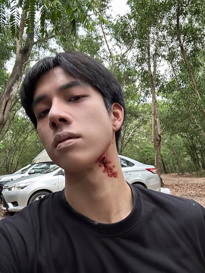 แฟรงค์ - ธนัตถ์ศรันย์ ซำทองไหล