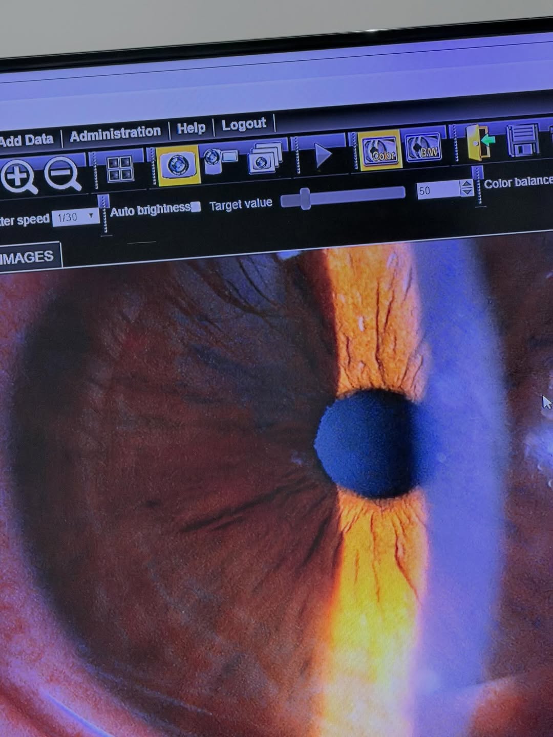 โอ้ - มาริโอ้ เมาเร่อ