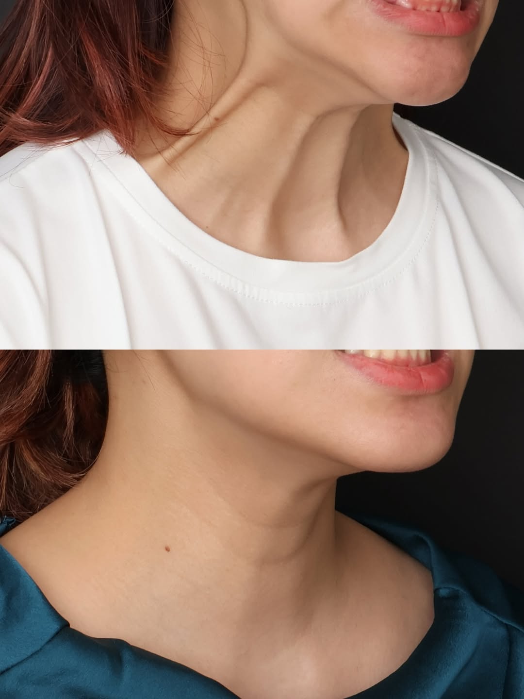 โอ๊ค - สมิทธิ์ อารยะสกุล