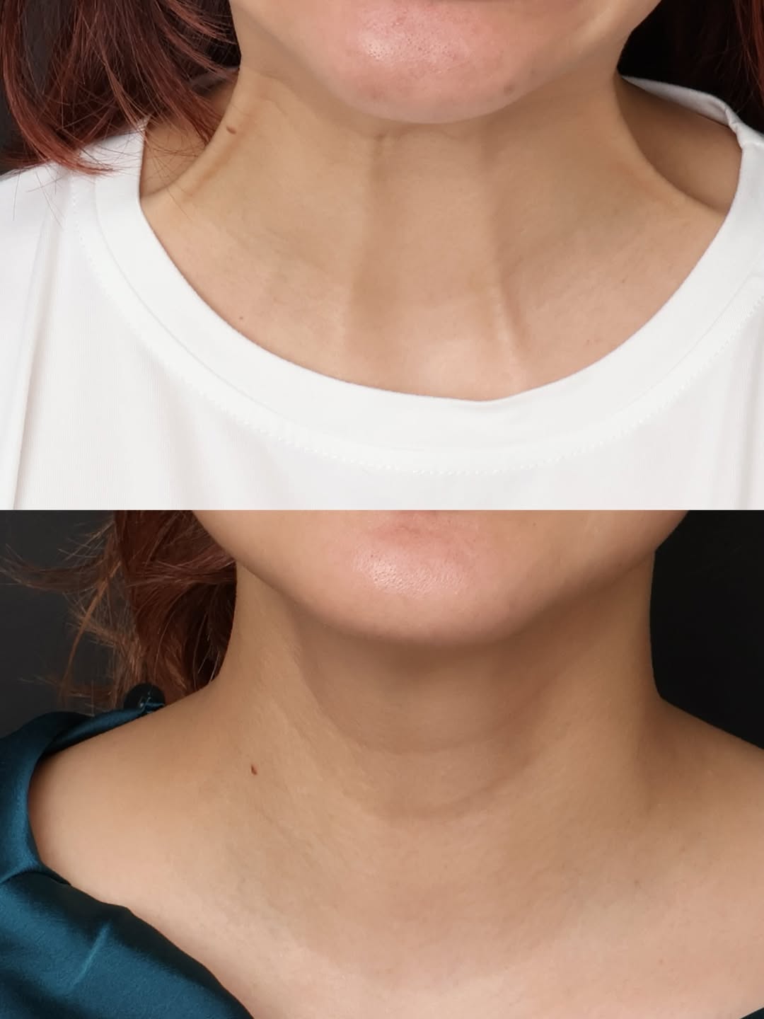 โอ๊ค - สมิทธิ์ อารยะสกุล