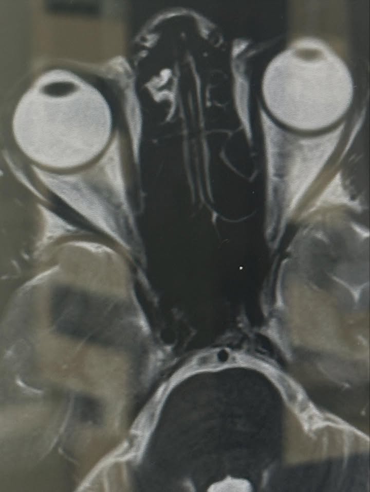 ญาญ่า - อุรัสยา เสปอร์บันด์