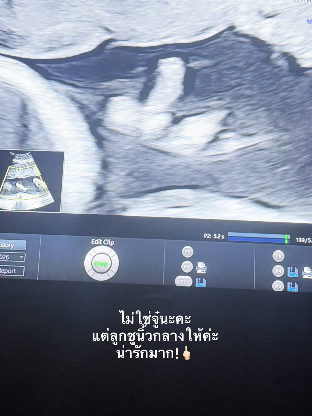 เมย์ - พิชญ์นาฏ สาขากร