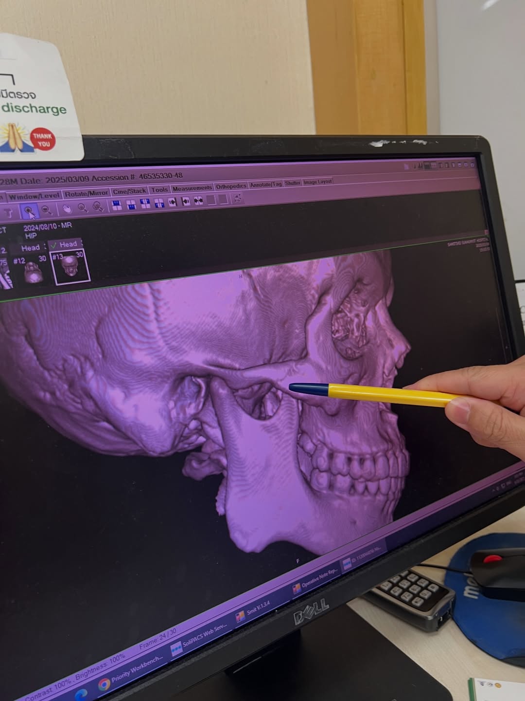 จั๋ง - วิกร บูรณภิญโญ