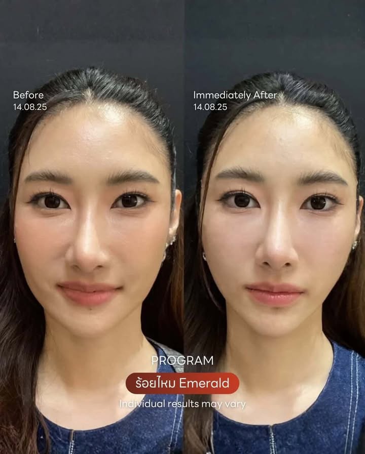 ยีนส์ - เกวลิน ศรีวรรณา