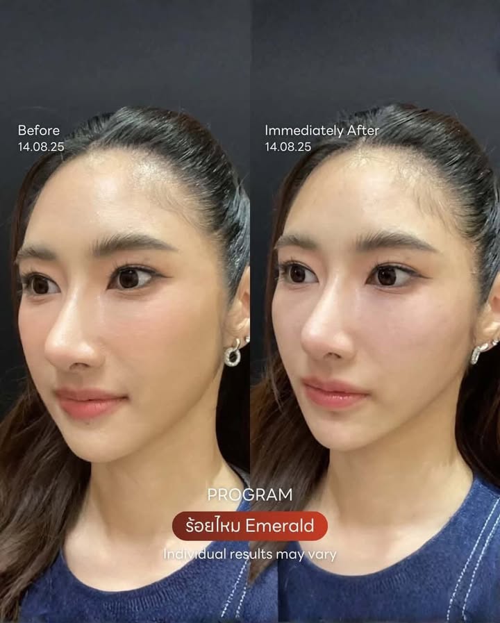 ยีนส์ - เกวลิน ศรีวรรณา