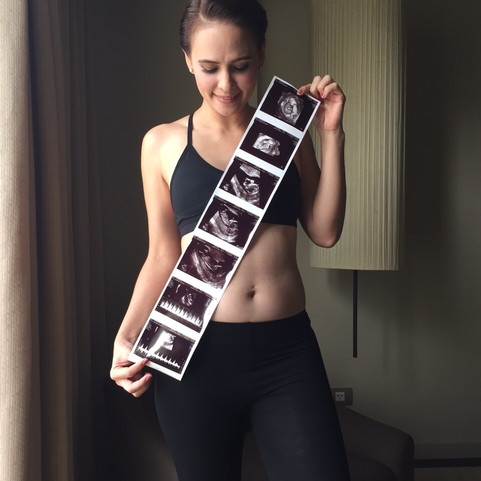 แอน - อลิชา หิรัญพฤกษ์