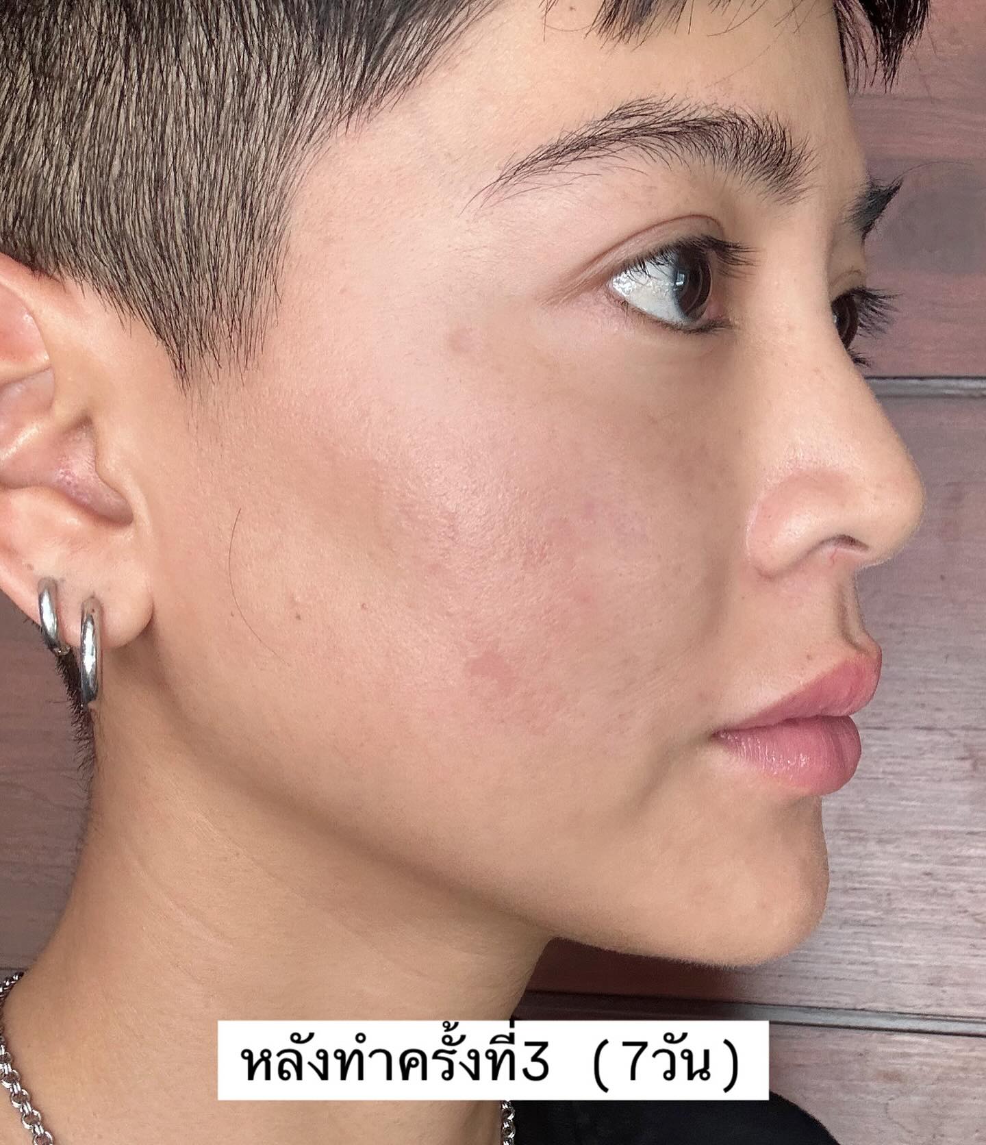 สายป่าน - อภิญญา สกุลเจริญสุข