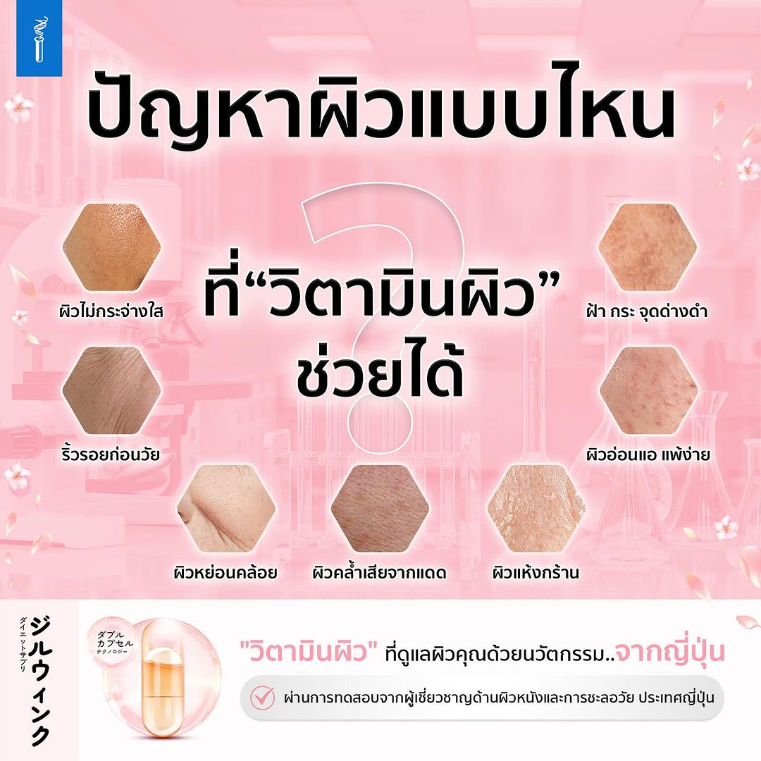 บีม - กวี ตันจรารักษ์