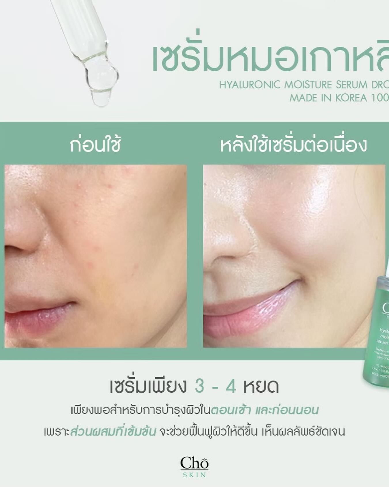 เนย - โชติกา วงศ์วิลาศ